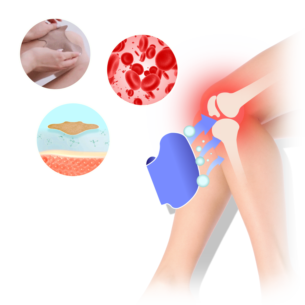 מדבקות להקלה בכאבי ברכיים