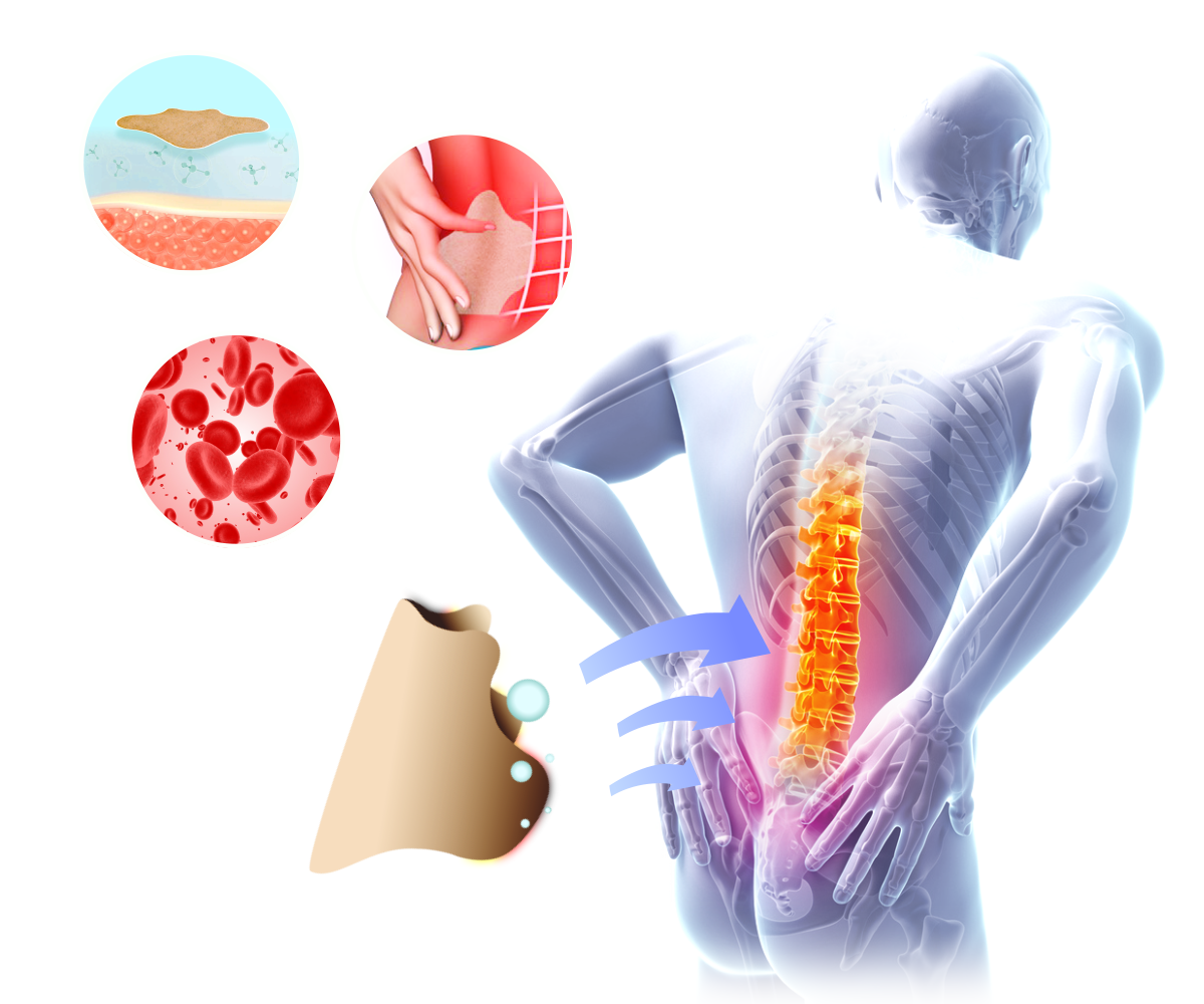 מדבקות להקלה בכאבים בגב - Aloeteva