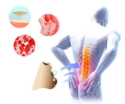 מדבקות להקלה בכאבים בגב - Aloeteva